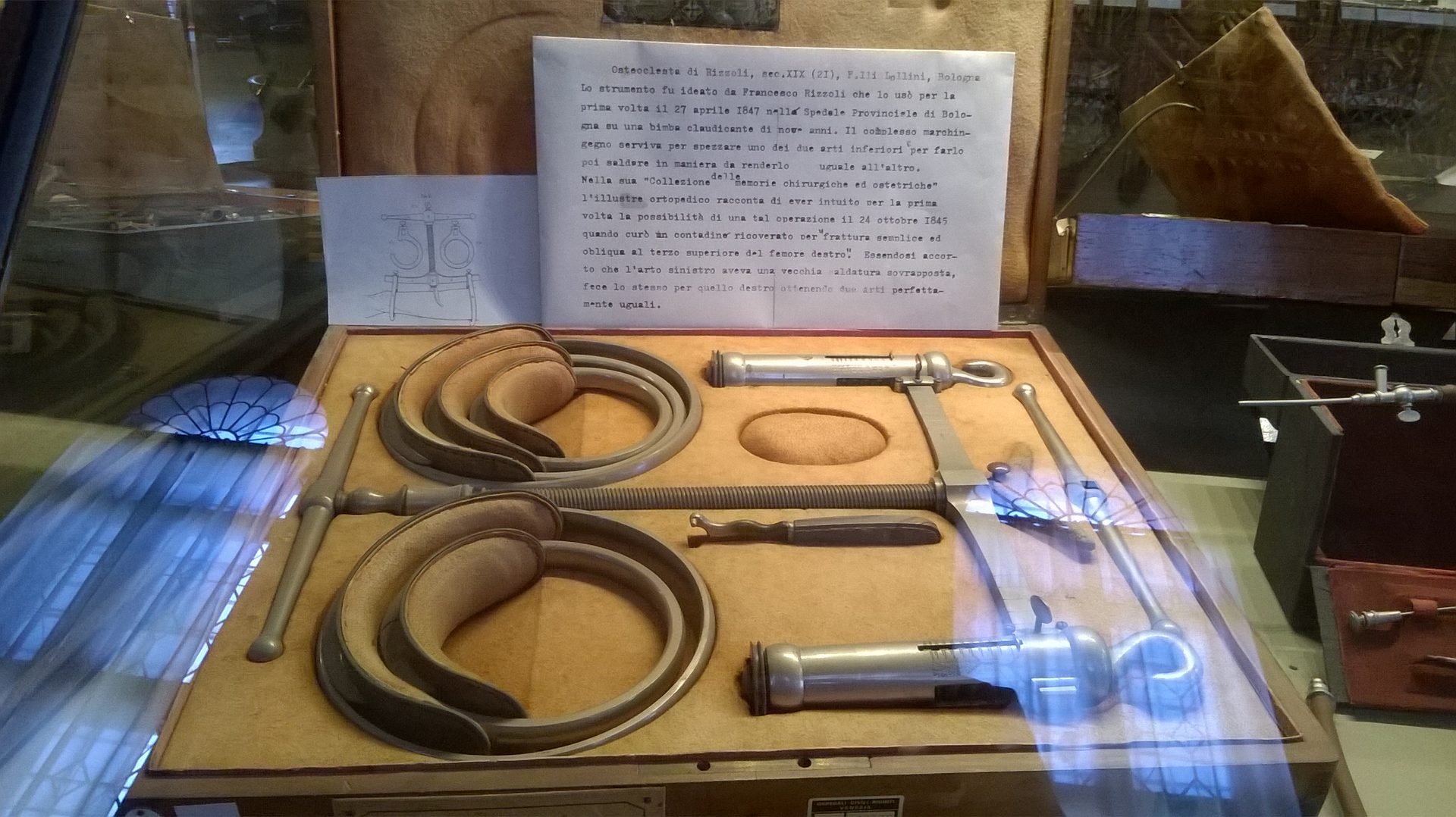 Francesco Rizzoli's osteoclast, Scuola Grande di San Marco historical collection, Venice.jpg